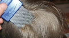 Češalj za češljanje ušiju i gid